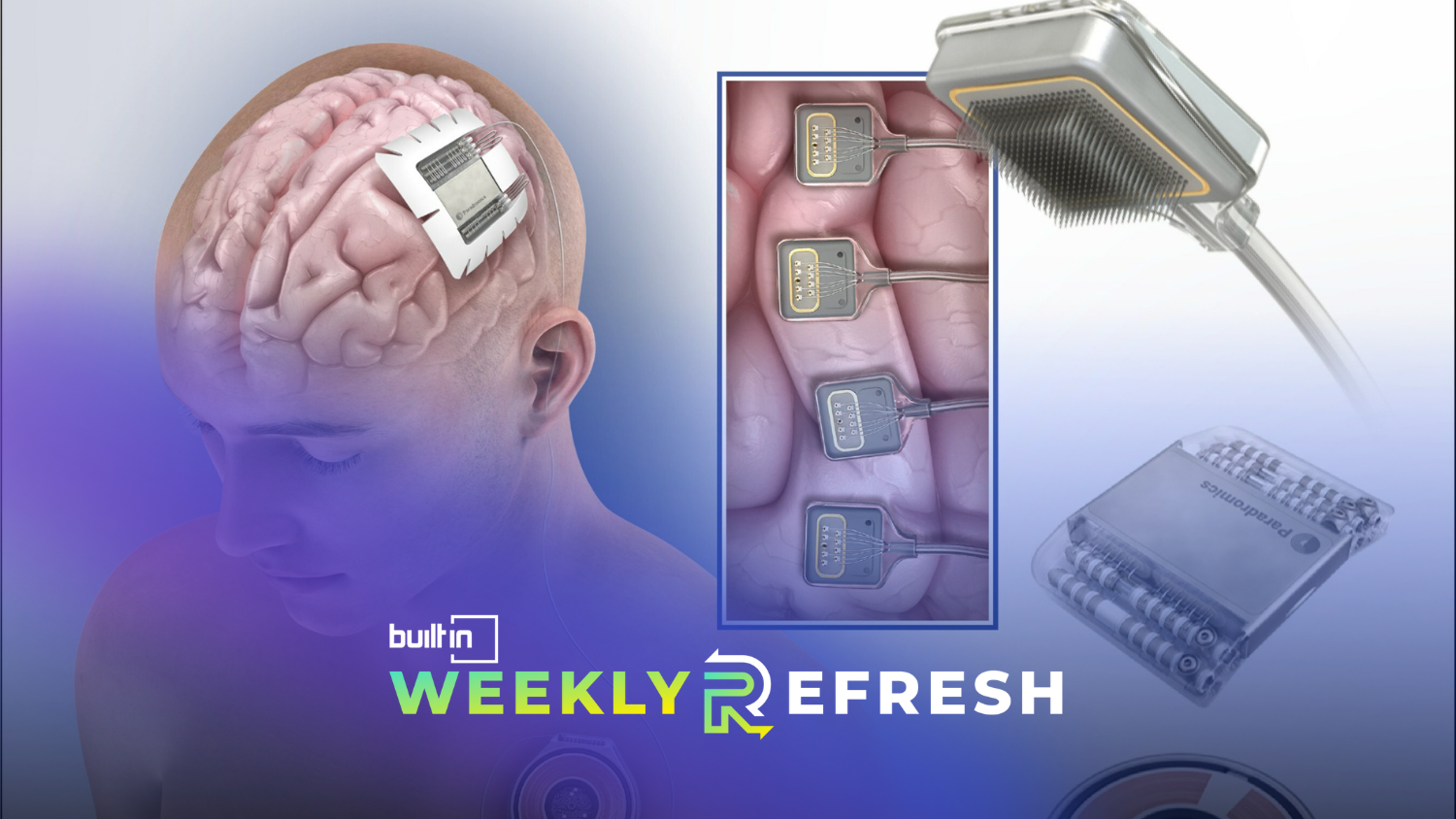 An illustration of Paradromics' brain computer device.