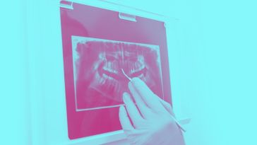 x-ray of teeth at dentist