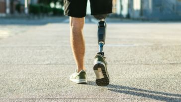 photo of a man wearing a robotic prosthetic leg.