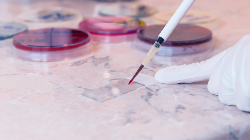 Doctor pulling blood to test on clear plastic strip