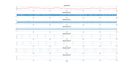 wavelet-transform