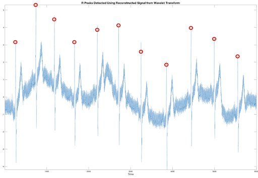 wavelet-transform