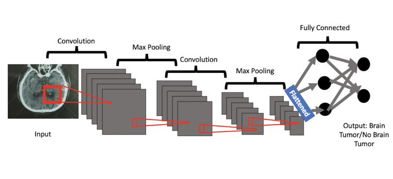 An illustration of the process by which AI interprets MRI scans