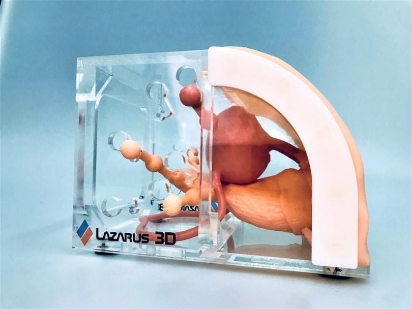 7 3D Printing in Medicine Examples You Should Know