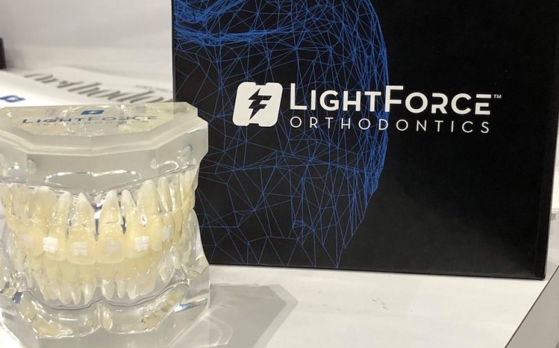 lightforce orthodontics 3d printing medicine